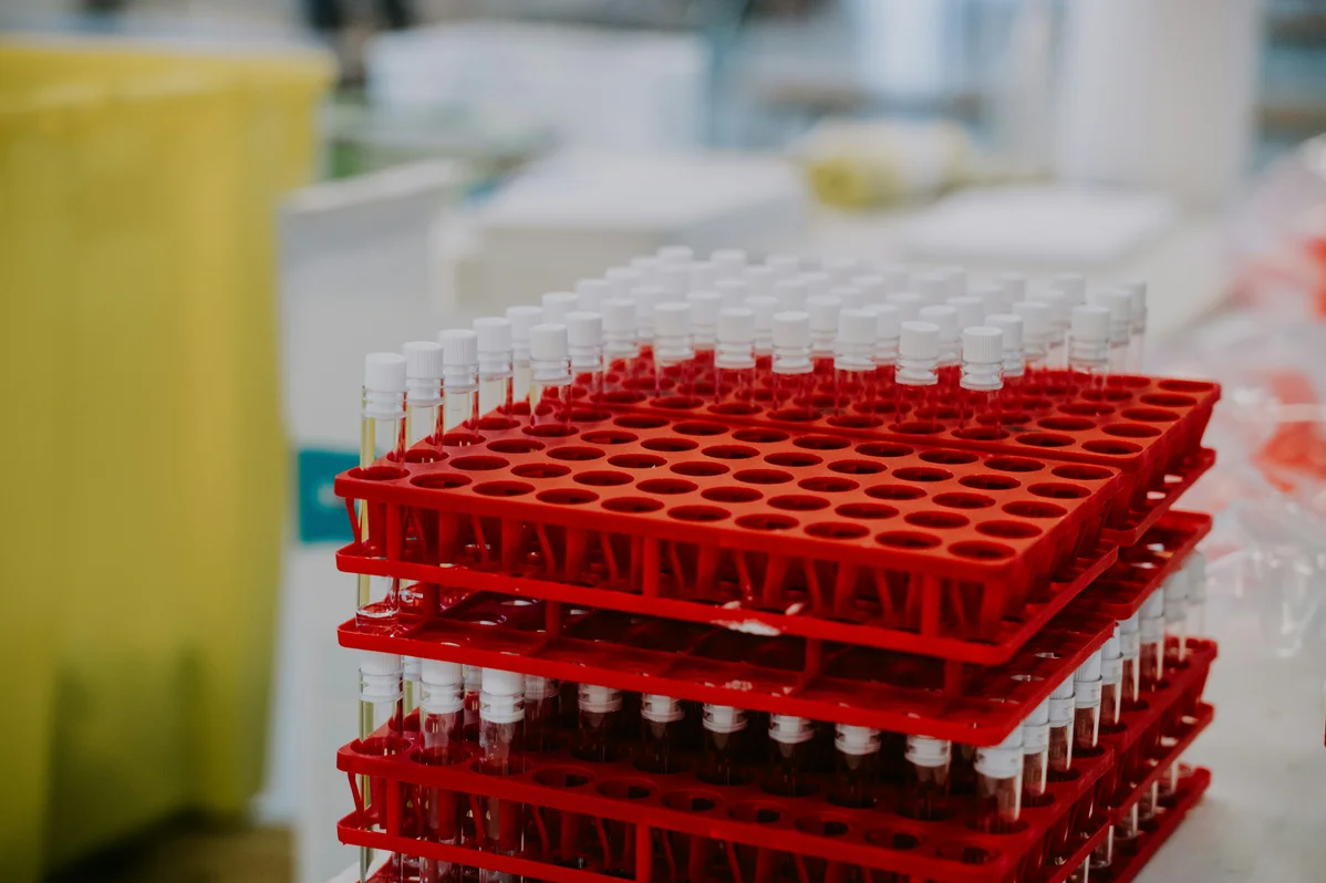 Laboratory equipment used for blood testing of Lyme disease biomarkers Laboratory equipment used for blood testing of Lyme disease biomarkers