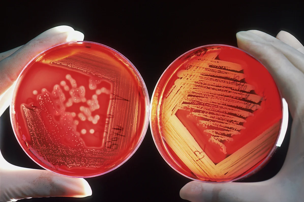 Laboratory testing of gut bacteria for immune response Laboratory testing of gut bacteria for immune response