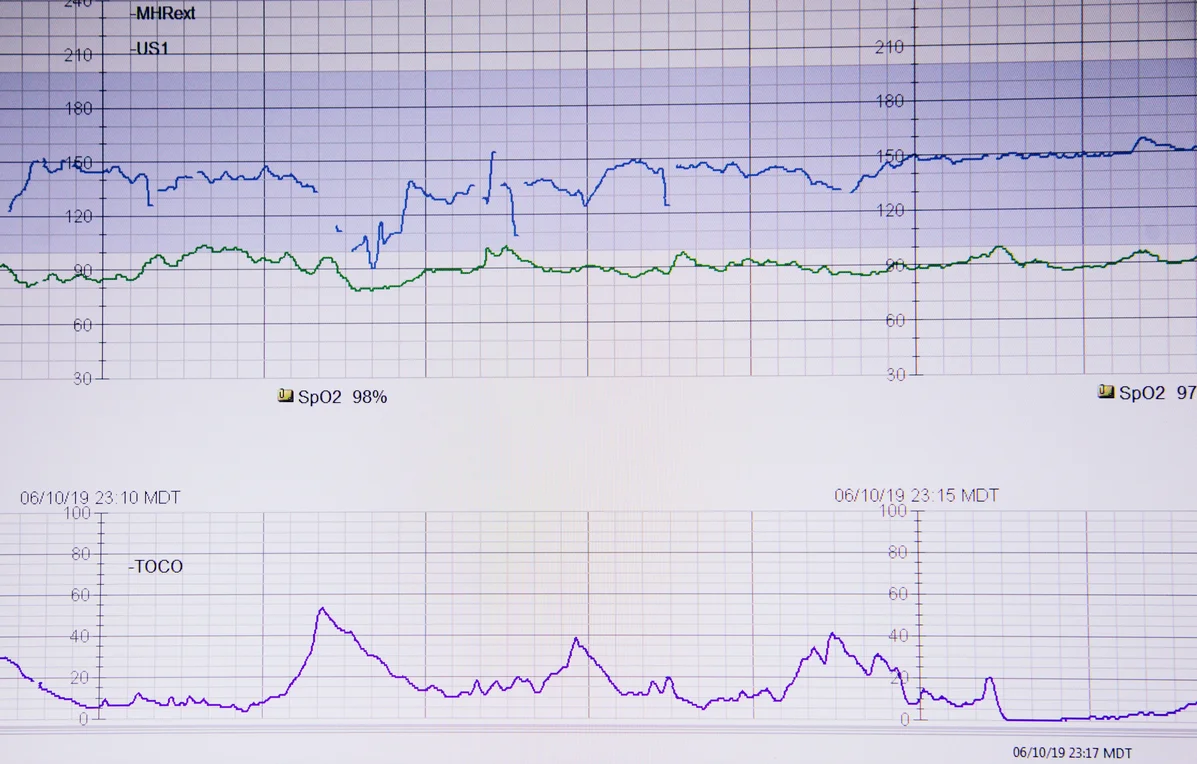 chart showing different running intensity zones chart showing different running intensity zones