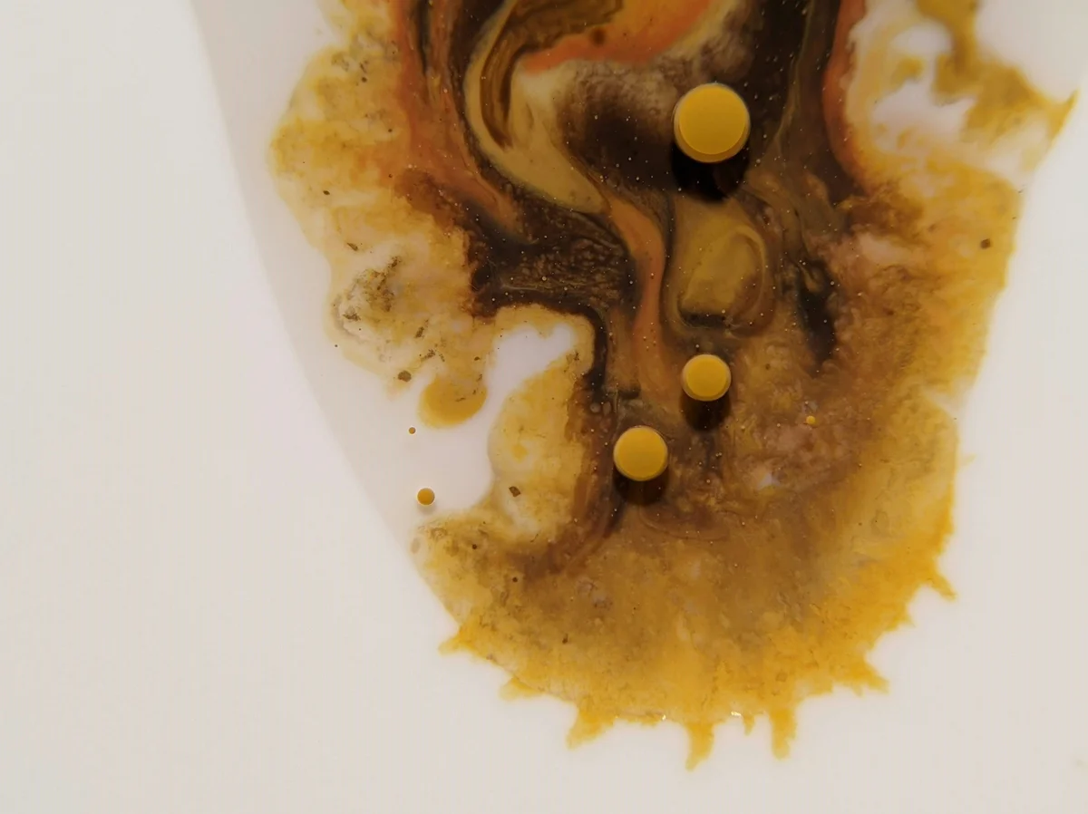 Toilet seat showing signs of discoloration and stains Toilet seat showing signs of discoloration and stains